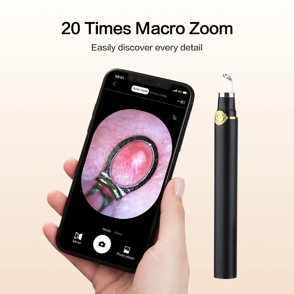 visual blackhead remover with camera