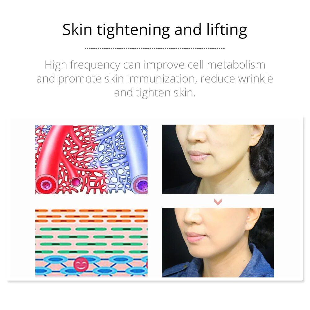 portable high frequency facial therapy wand