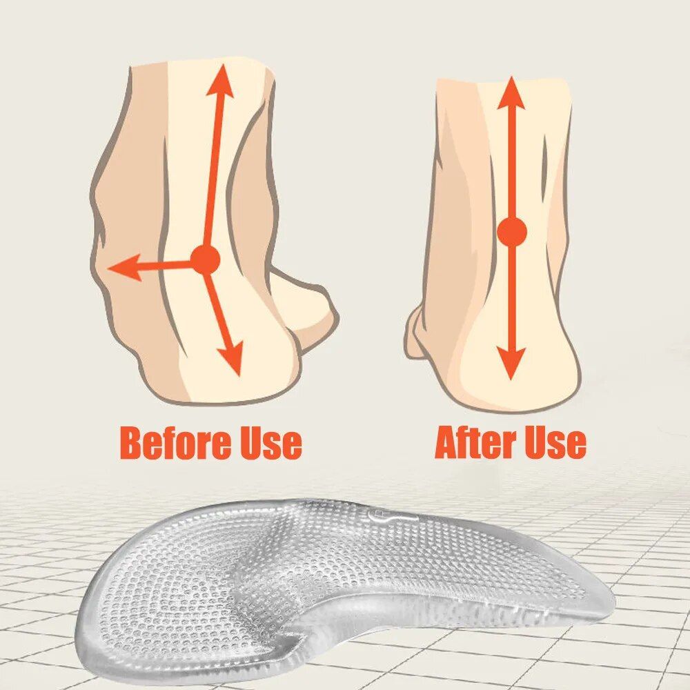 comfort gel orthopedic insoles arch support for flat feet & plantar fasciitis relief